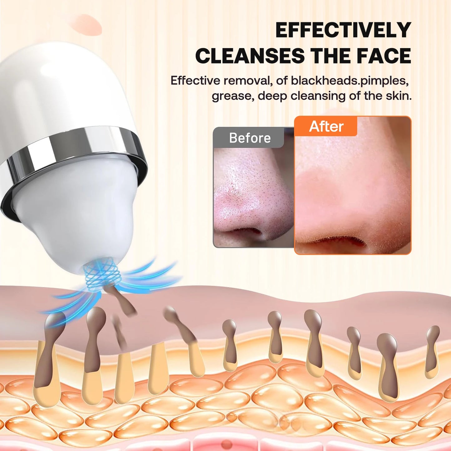 Blackhead Removal Vacuum